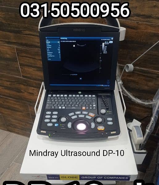 mindray ultrasound BA-88a bc-20s patient monitor ECG furniture 4