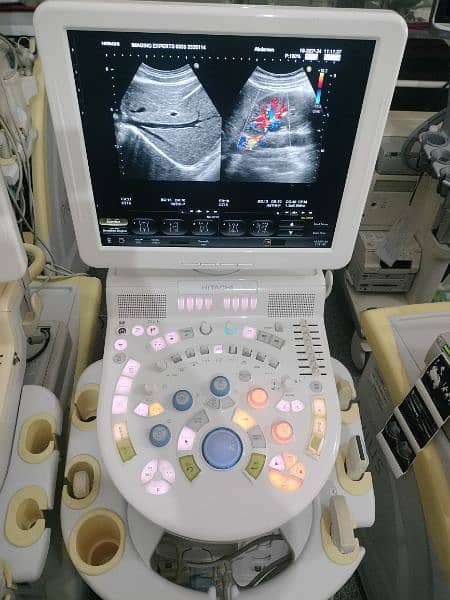 Latest Ultrasound machines japani fresh import 9