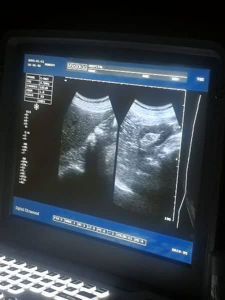 ultrasound machine for sale 2