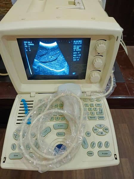 ultrasound machine for sale 1