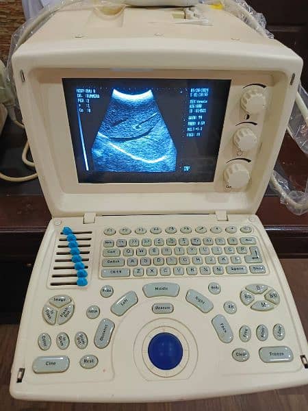 ultrasound machine for sale 3