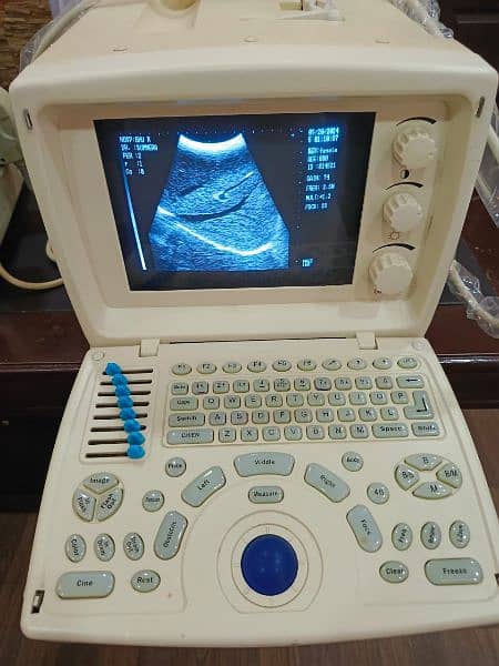 ultrasound machine for sale 4