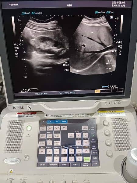 ultrasound machine for sale 17