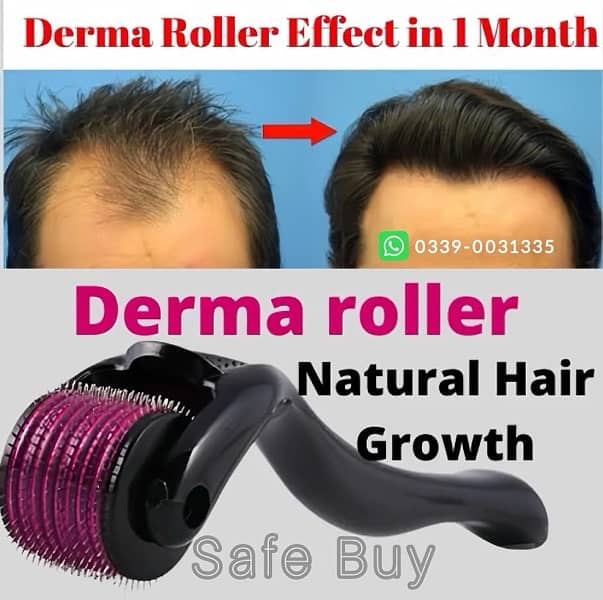 Derma Roller 540micro needles 0