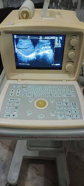 Ultrasound scanner WellD 9608 1