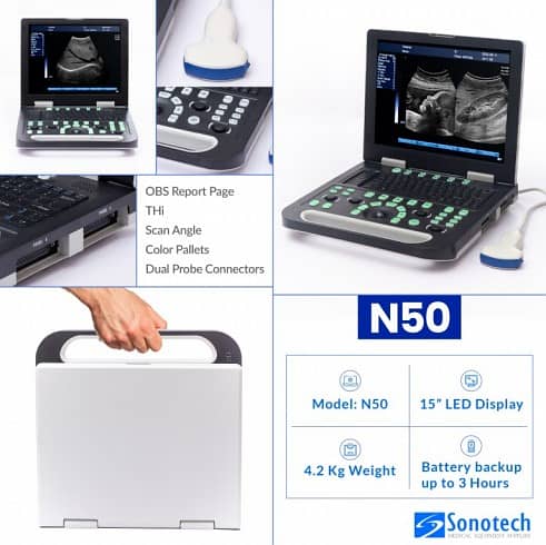 ALL TYPES OF ULTRASOUND MACHINES AVAILABLE FOR SALE 8