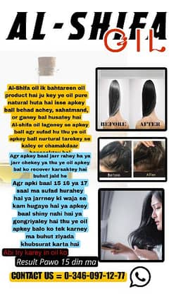 AL-SHIFA OIL to recover hair