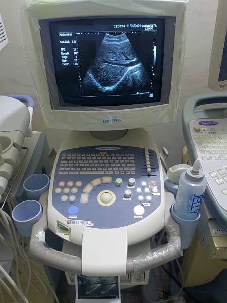 Ultrasound Machines 0333 3333 8596 7