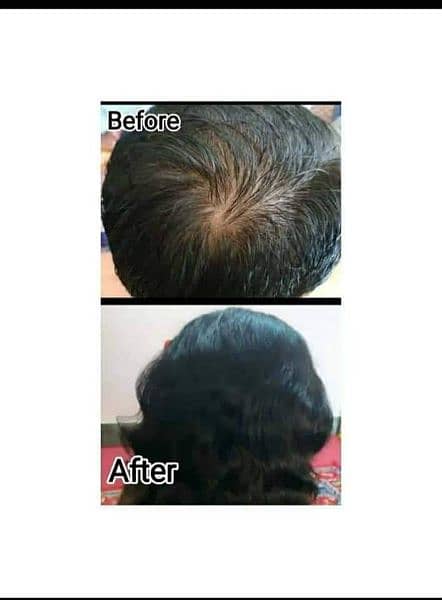 Hair And Care Growth Oil 2