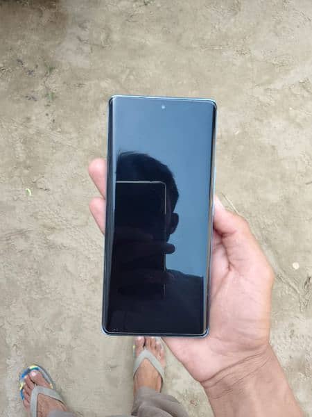 vivo v 30 e 5