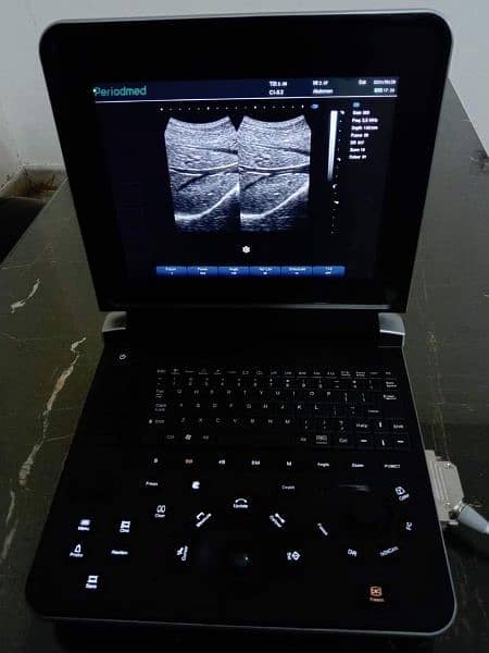 ULTRASOUND Machine 6