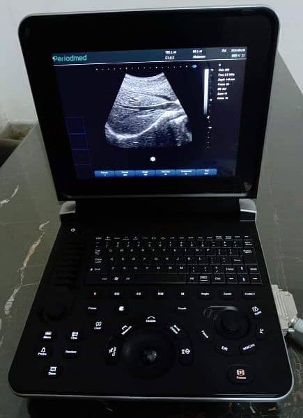 ULTRASOUND Machine 10