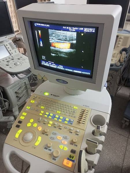 Ultrasound machine color Doppler and gray scale 7