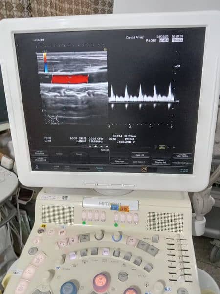 Ultrasound machine color Doppler and gray scale 8