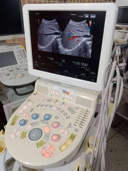 Ultrasound machine color Doppler and gray scale 15