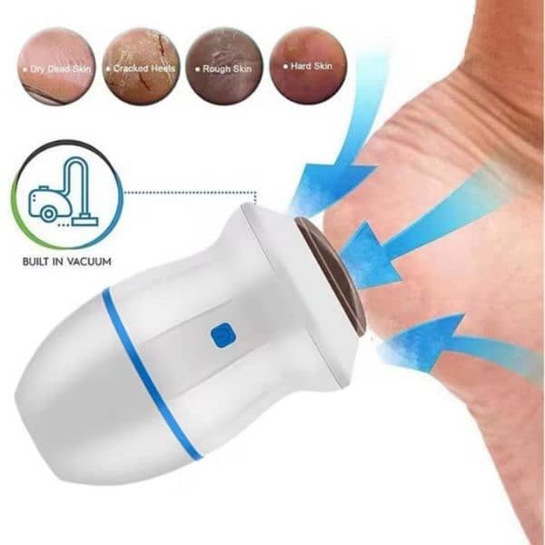 callus remover for heels 1