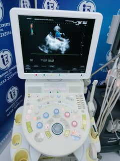 Ultrasound Machines Japani Toshiba Aloka Hitachi