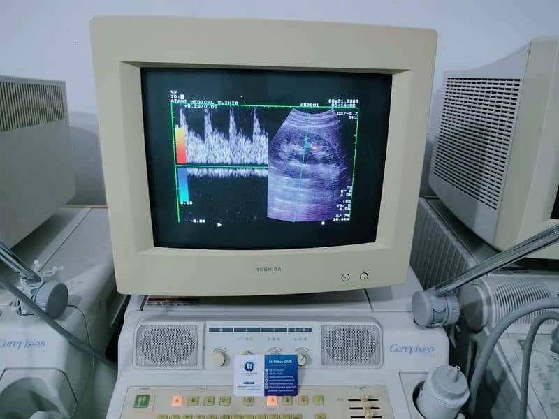 Color Doppler Toshiba & GE Logiq ViVid 7