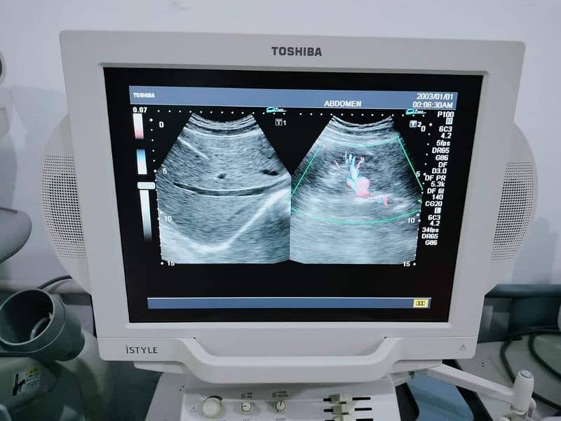 Toshiba LCD based Color Doppler Nemio XG 4