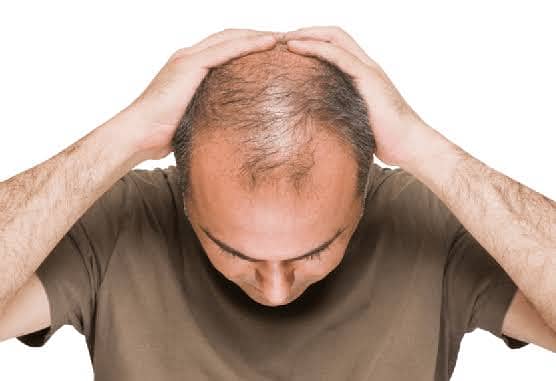 THE TREATMENT OF BALDNESS MAKES YOUR HAIR LONG. STRONG DARK & SILKY. . 4