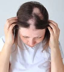 THE TREATMENT OF BALDNESS MAKES YOUR HAIR LONG. STRONG DARK & SILKY. 2