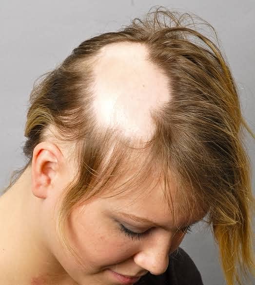 THE TREATMENT OF BALDNESS MAKES YOUR HAIR LONG. STRONG DARK & SILKY. 3