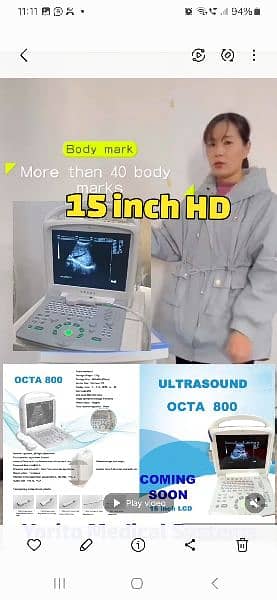 OCTA 880 DIGITAL BATTERY OPRATED 2025  ULTRASOUND MACHINE  COMIG 1