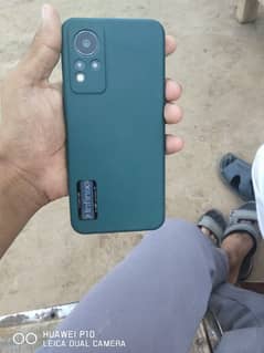 infinix note 11 exchange possible 03106187124