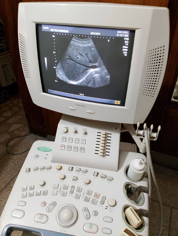 ultrasound machine / Toshiba / japanese ultrasound machines 10