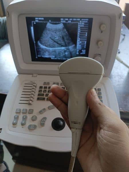 Ultrasound machine 1