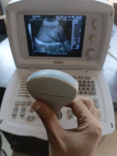 Ultrasound machine 2