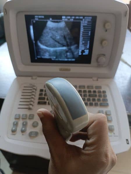 Ultrasound machine 3