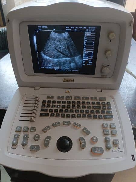 Ultrasound machine 4