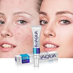 Acne Scar Removal ( free delivery all over Pakistan)