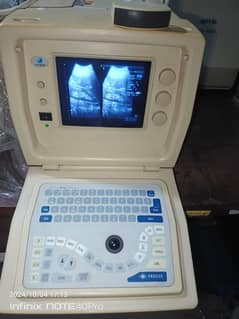 Ultrasound Machine used