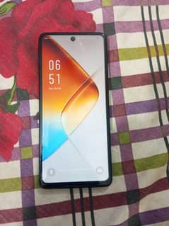 infinix note 30 pro daba pack 0