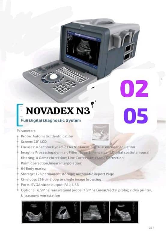 NOVADEX N3 PLUS /ORIAL PLUS PORTABLE HD LCD ULTRASOUND MACHINE 2