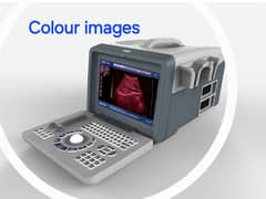 most famous brand and model NOVADEX N3 PLUS ULTRASOUND MACHINE