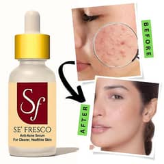 Se' Fresco Anti-Acne Face Serum for Clearer Skin - 30g