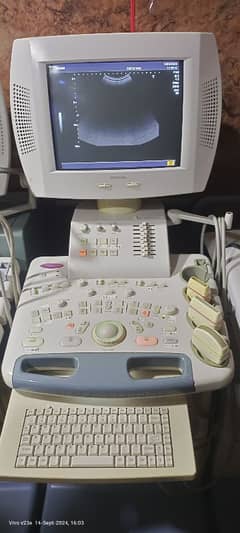 Toshiba nemio 20 ultrasound