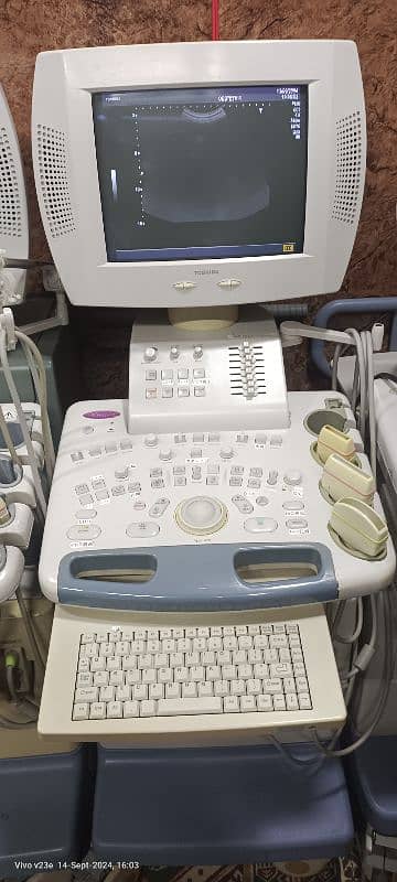 Toshiba nemio 20 ultrasound 1