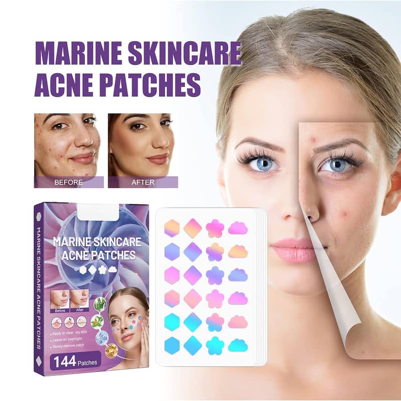 Portable 144Pcs Face Pimple Star Acne Patches, 0