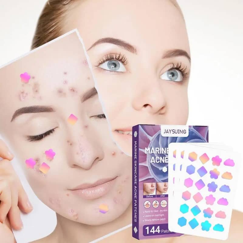 Portable 144Pcs Face Pimple Star Acne Patches, 17