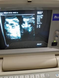 ultrasound machine is Available for sale Urgently