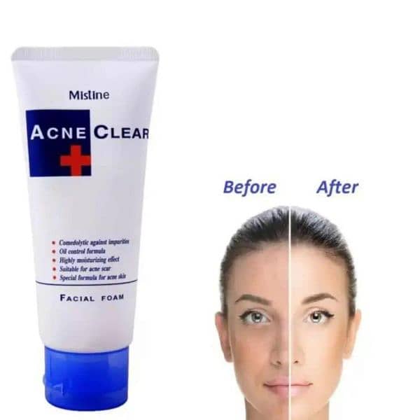 Acne Clear 1