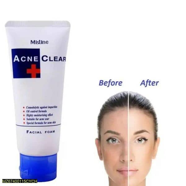 Acne Clear 3