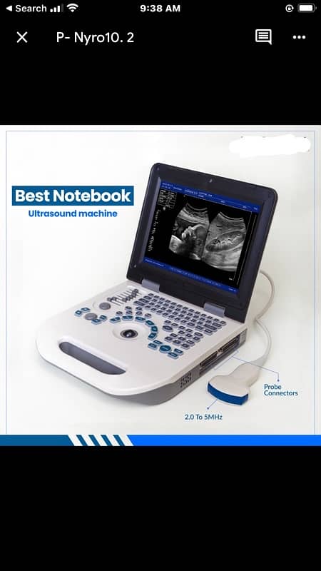 Brand New Novadex Nyro10 BW 12.1” LED Battery Operated Ultrasound 0