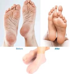 Silicone Gel Socks - Foot Care Protector