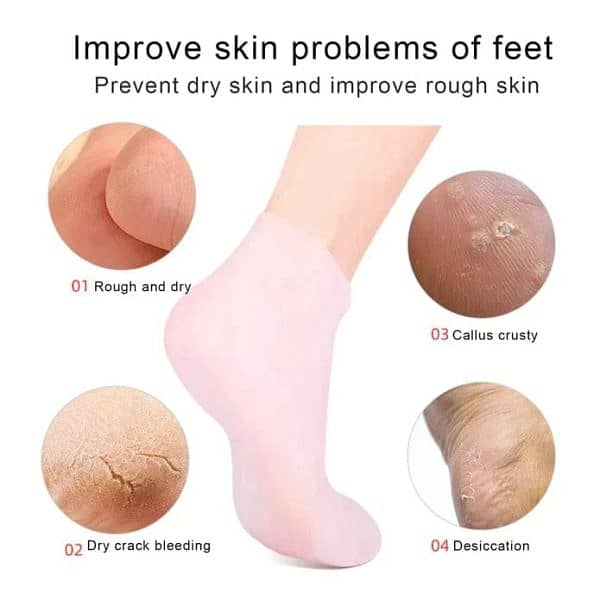 Silicone Gel Socks - Foot Care Protector 1