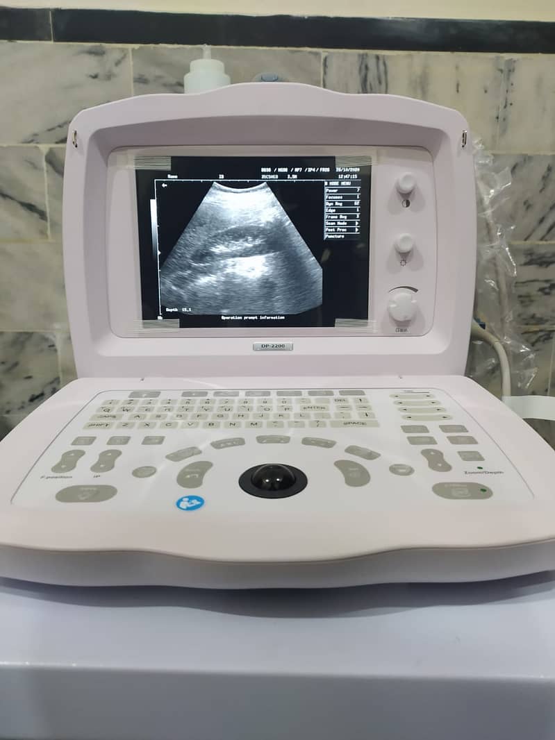 Ultrasound machine available of top brands in refurb and new condition 2